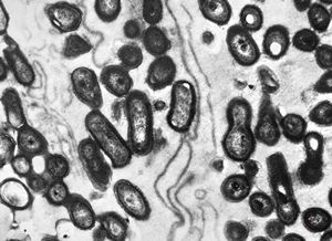 M,39y. | skin - folliculitis M,39y. | skin - folliculitis